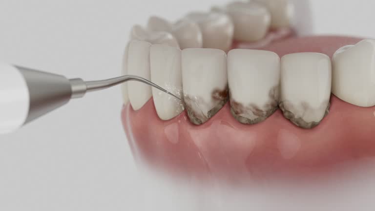 Trusted Dental Implants service in Sanford, FL - Dentist Open Now